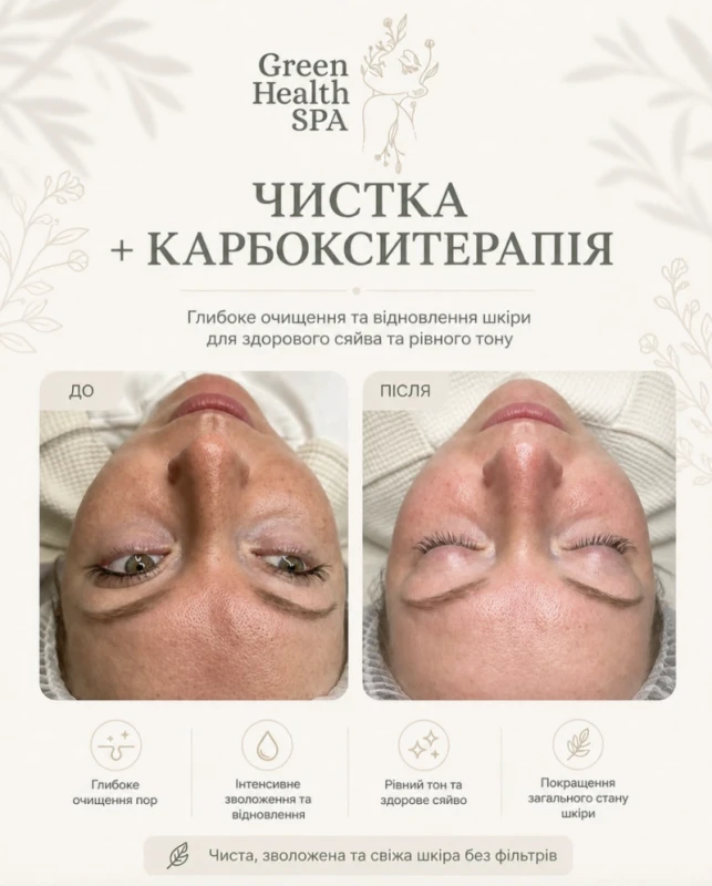Фото з портфоліо Green Health Spa
