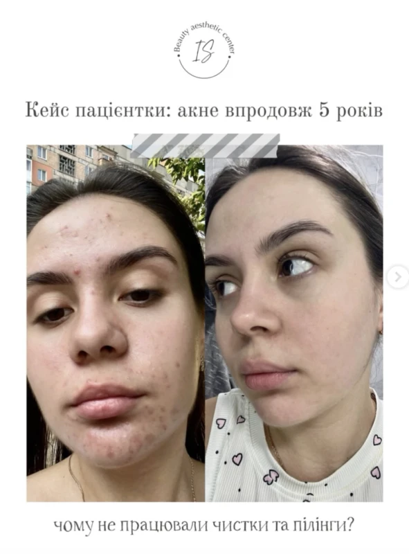 Фото 3 з портфоліо Dr.irina.ua
