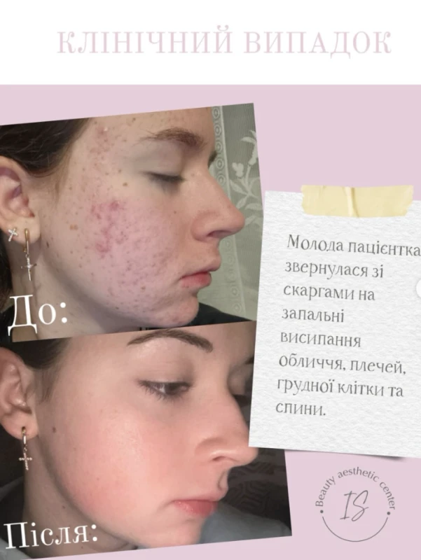 Фото 4 з портфоліо Dr.irina.ua