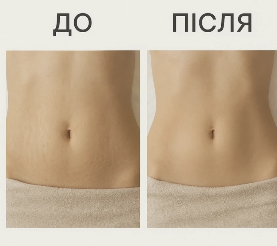 Фото 2 из портфолио Re:Body Studio