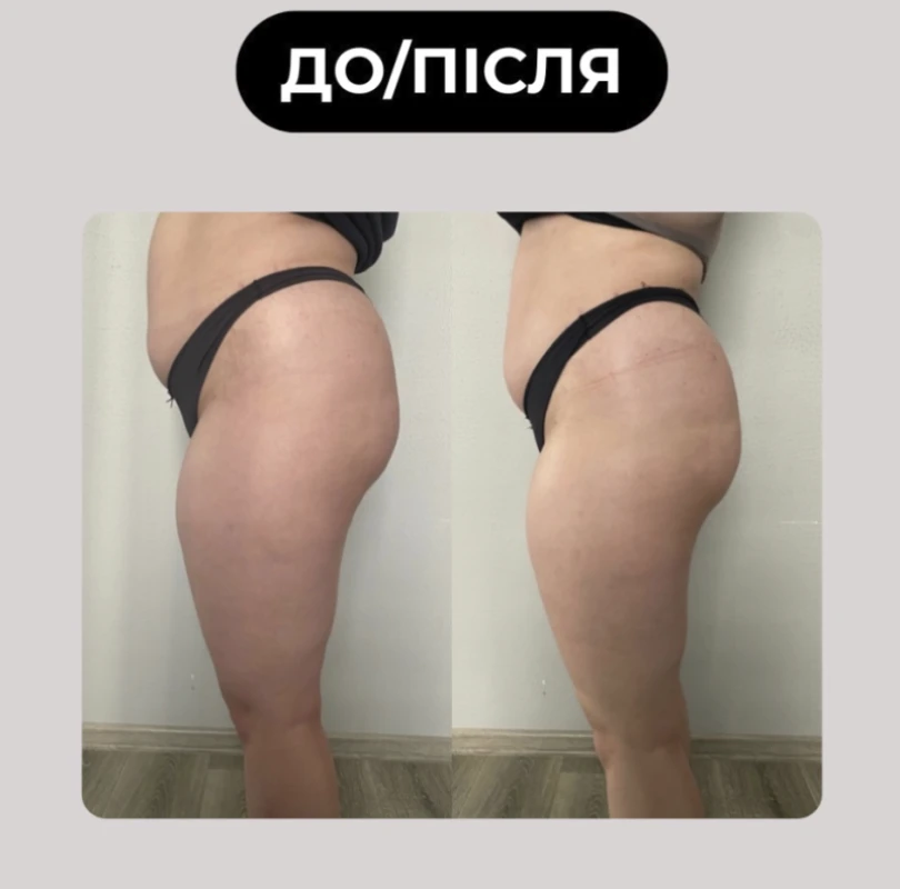 Фото 3 из портфолио Re:Body Studio
