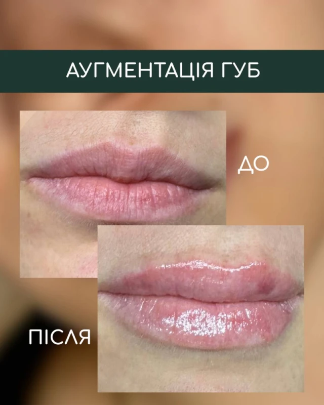Фото 2 з портфоліо Skin Flow Studio