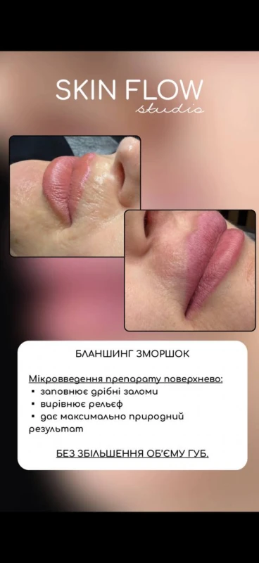 Фото 3 з портфоліо Skin Flow Studio