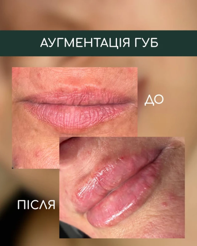 Фото 4 з портфоліо Skin Flow Studio
