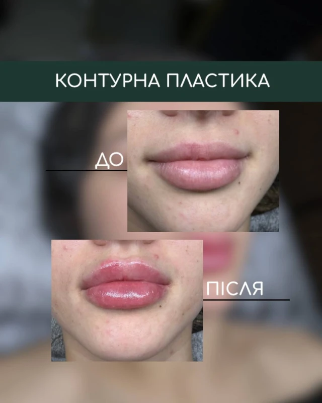 Фото 5 з портфоліо Skin Flow Studio