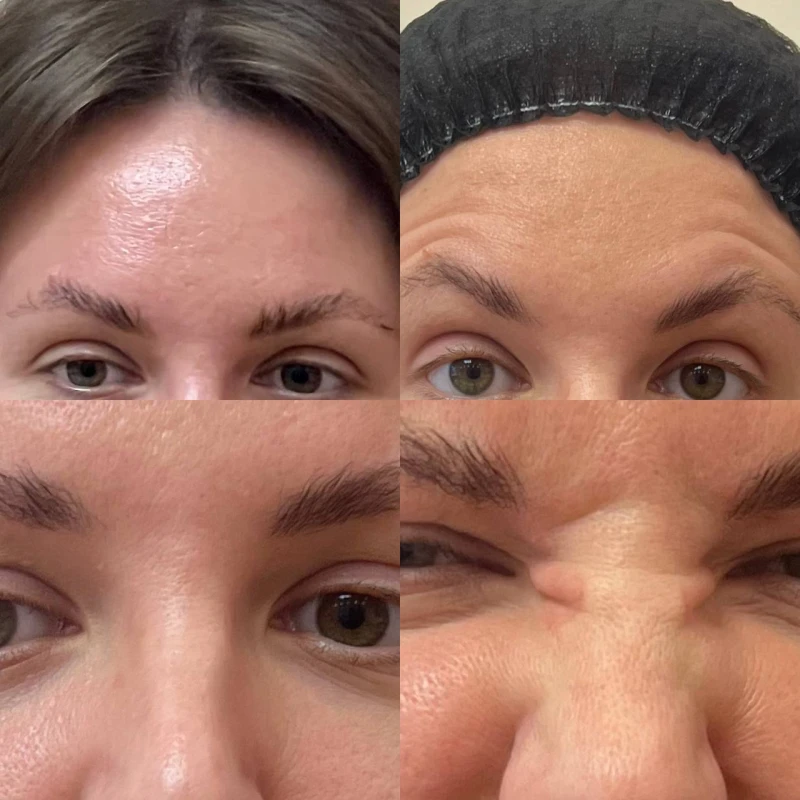 Фото 2 из портфолио Karmanova Cosmetology Center