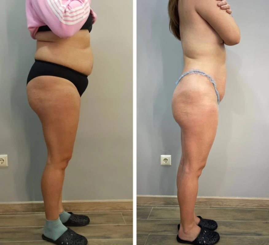Фото 3 из портфолио Body Control