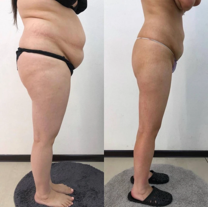 Фото 4 из портфолио Body Control