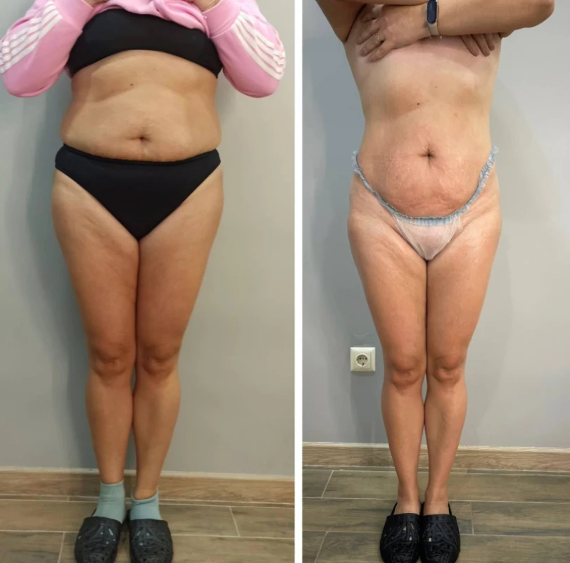Фото 5 из портфолио Body Control
