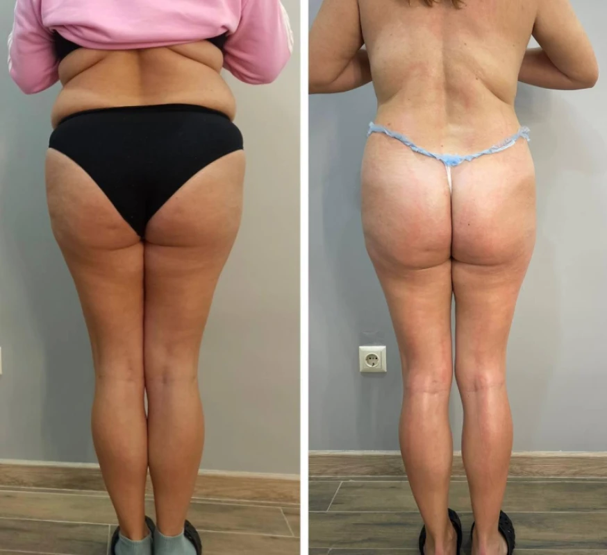 Фото 6 из портфолио Body Control