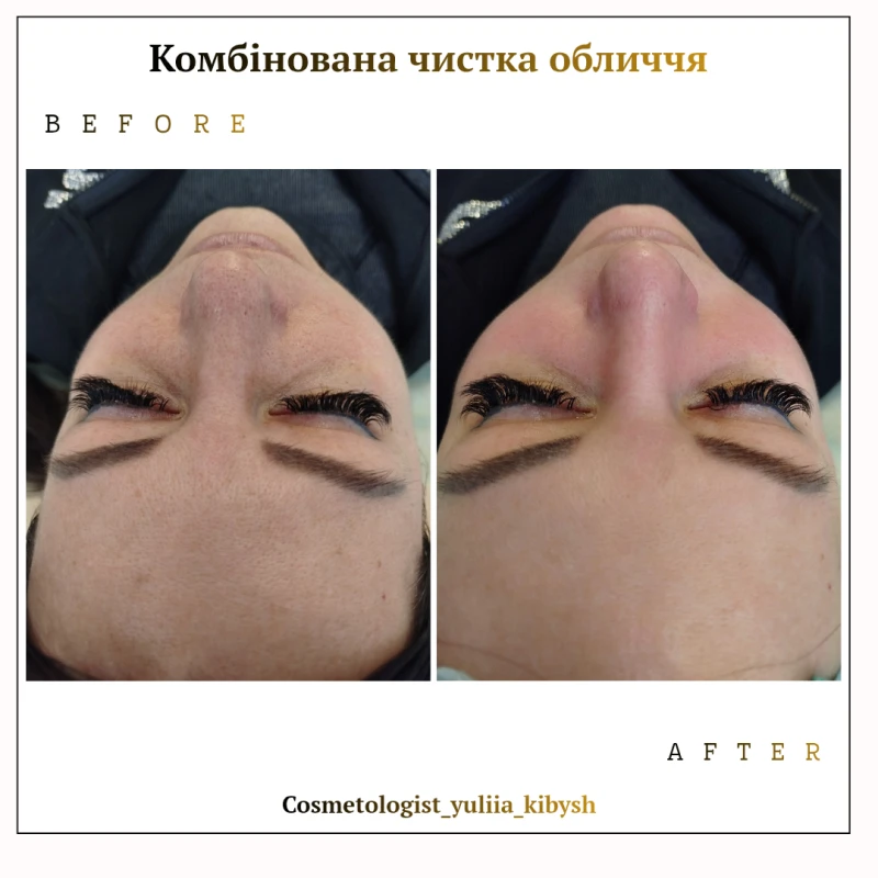 Фото 3 з портфоліо DERMA|PRO Cosmetology
