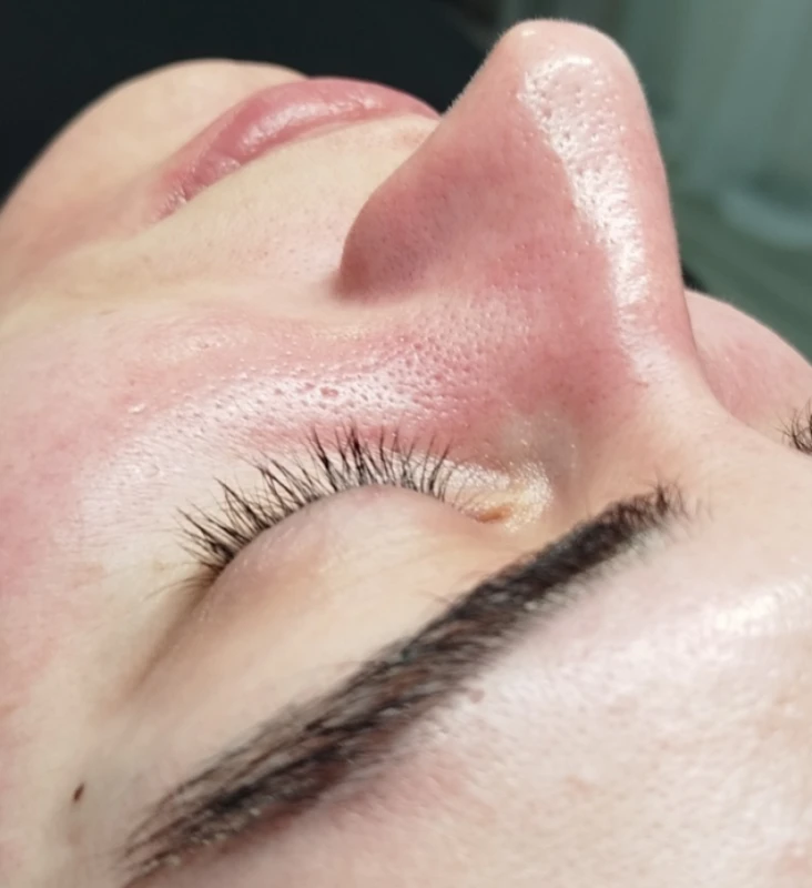 Фото 4 з портфоліо DERMA|PRO Cosmetology