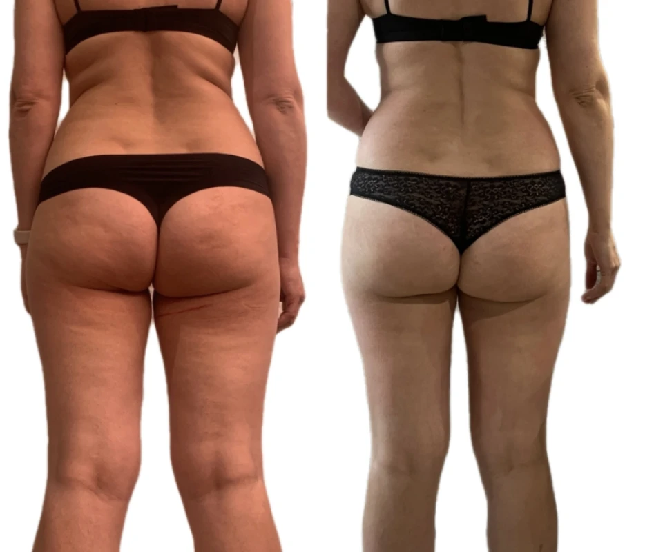 Фото 2 из портфолио BodySculpt Hub