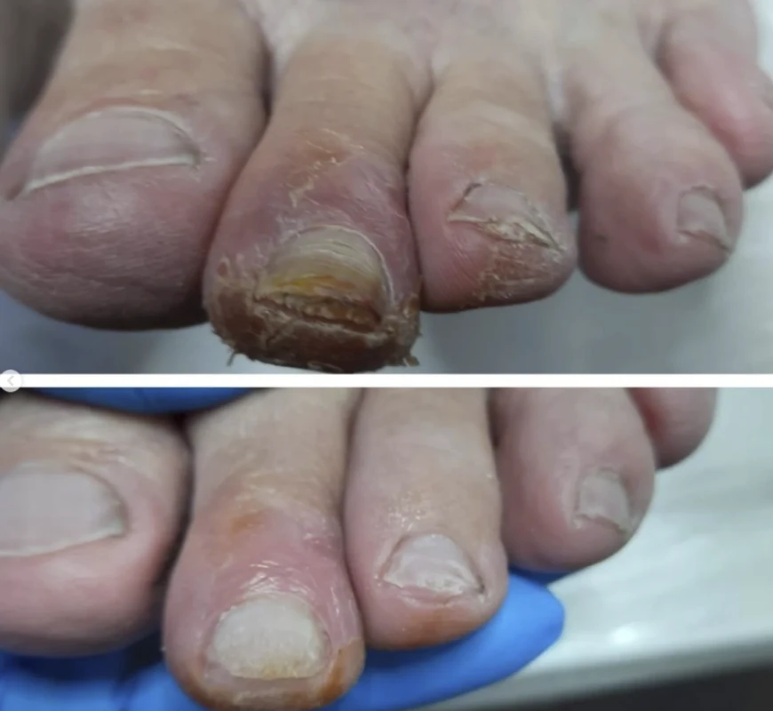 Фото з портфоліо Подологічний центр "Здорові ніжки"