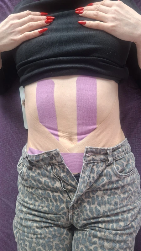 Фото из портфолио Студія тейпування та корекції фігури Lux taping