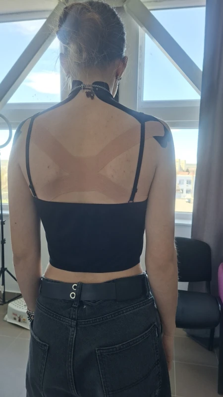 Фото 2 из портфолио Студія тейпування та корекції фігури Lux taping