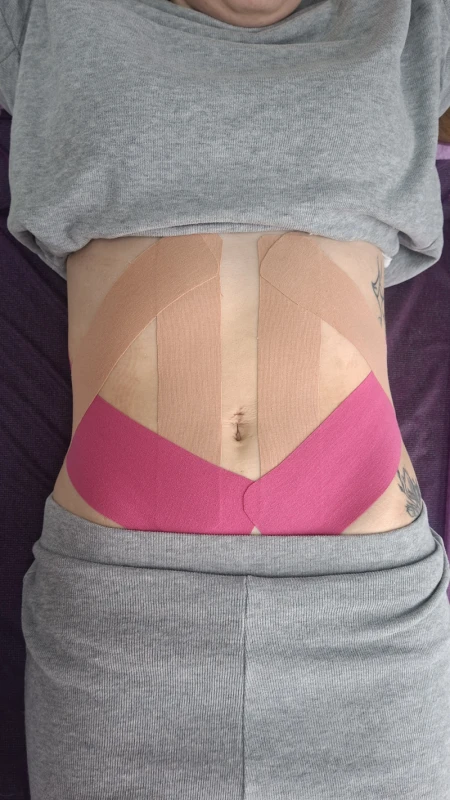 Фото 3 из портфолио Студія тейпування та корекції фігури Lux taping