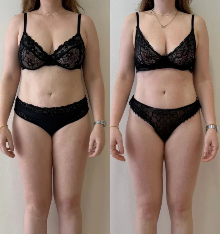 Фото з портфоліо Косметолог масажист Endoslim