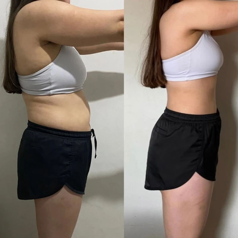 Фото 2 з портфоліо Косметолог масажист Endoslim
