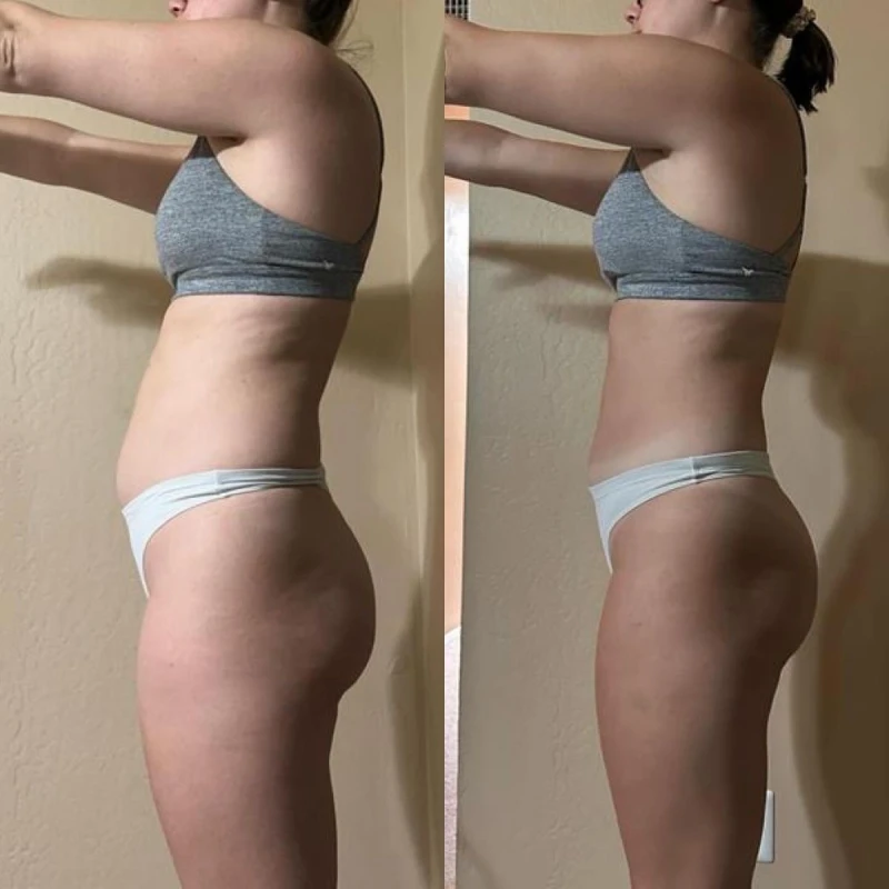 Фото 3 з портфоліо Косметолог масажист Endoslim