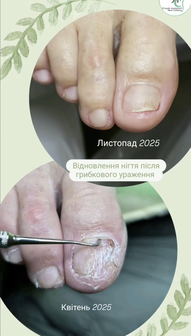 Фото з портфоліо Студія подології Яни Соболь