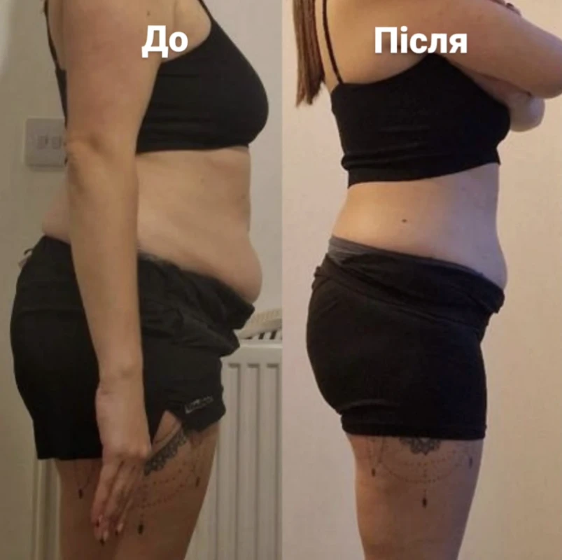 Фото з портфоліо ЕТТО Студія корекції фігури