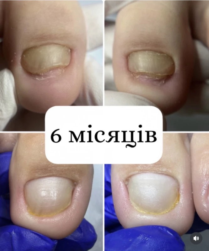 Фото з портфоліо Подологічна студія Віталіни Шаферистової
